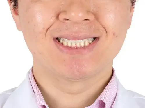중심선 · 비대칭 사례 03(전체 교정) 치료 후 얼굴 정면 사진 – 비대칭 장기 치료 사례, 치료기간 31개월